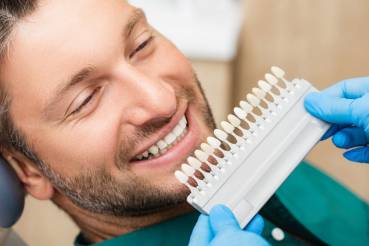 What are veneers? How much do they cost?