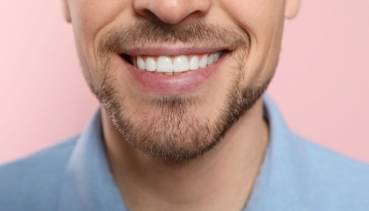 15% off, smile makeover treatments