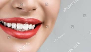 How far is too far? Cosmetic dentistry treatments